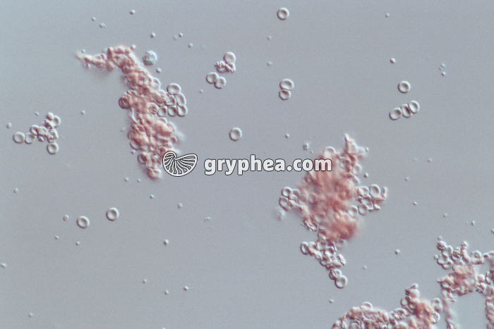 Sang agglutination des hématies x160 - gryphea.org